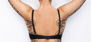 Bra Strap Syndrome – What You Should Know