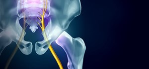 Understanding Sciatica Treatment and its Signs and Symptoms